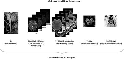 Modern Brainstem MRI Techniques for the Diagnosis of Parkinson's Disease and Parkinsonisms